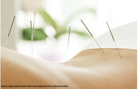 Does Acupuncture Therapy in Mumbai Really Work? Here’s What Science Says