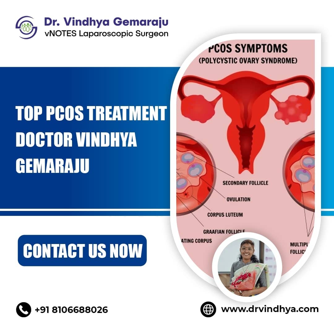Best PCOS Treatment in Hyderabad – Dr. Vindhya Gemaraju