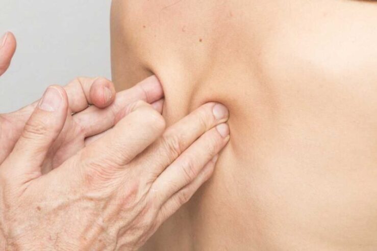Restore Balance and Relieve Muscle Pain with Remedial Massage Adelaide