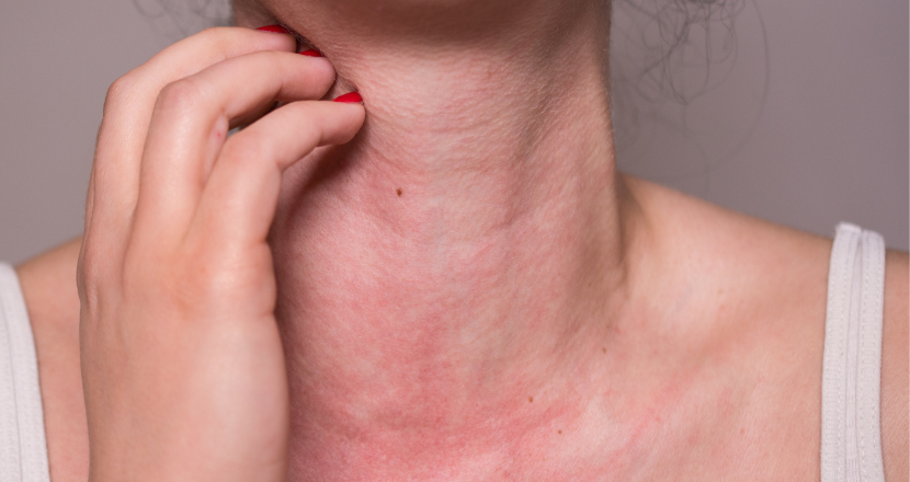 Texas Allergy Group PLLC